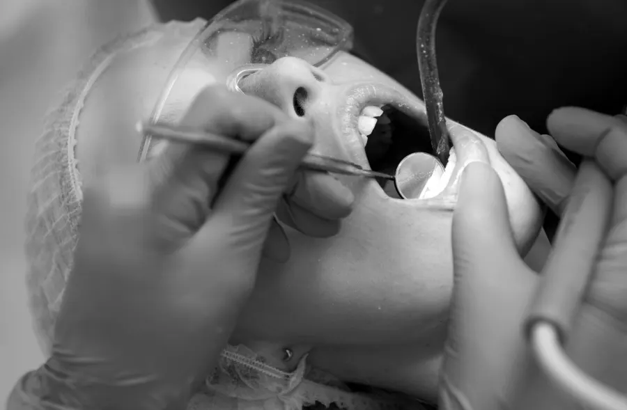 Dentist taking impression